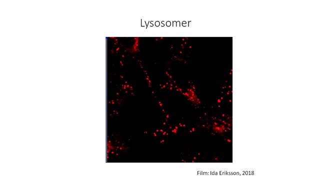 UR Samtiden - Lysosomernas roll vid cancer och alzheimer : Lysosomernas roll vid cancer och alzheimer